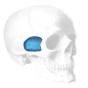 Implantech Temporal Shell Facial Implant
